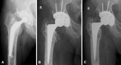 Fig. 1A–C