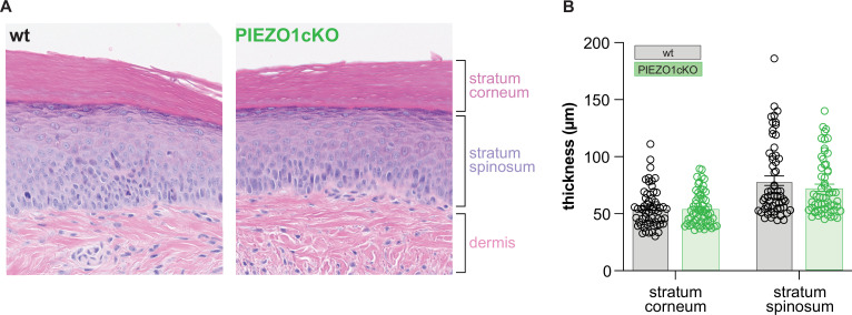 Figure 1—figure supplement 1.