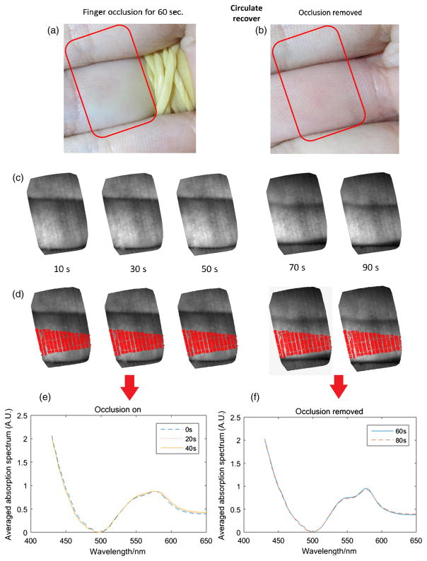 Fig. 13