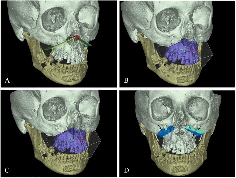 Fig. 2