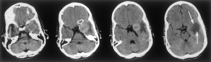 Fig 2.