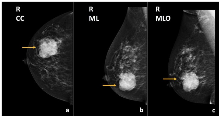 Figure 27