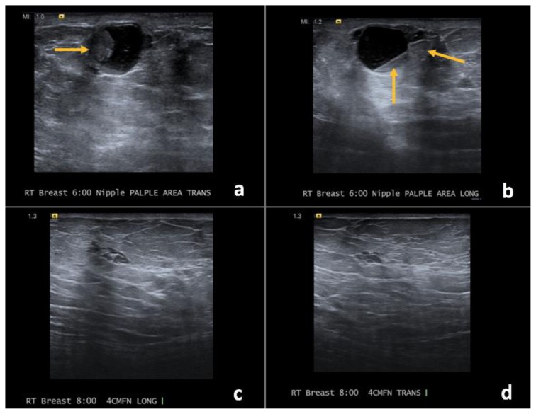 Figure 19