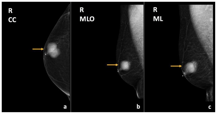 Figure 22