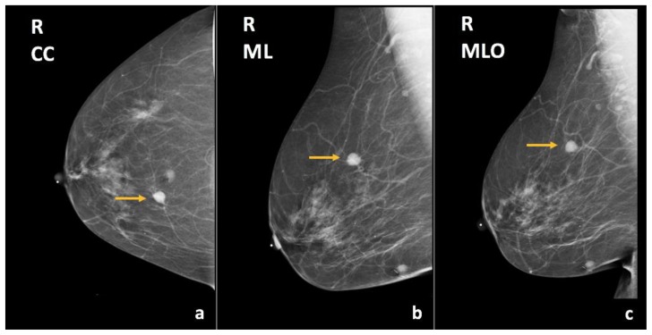 Figure 14