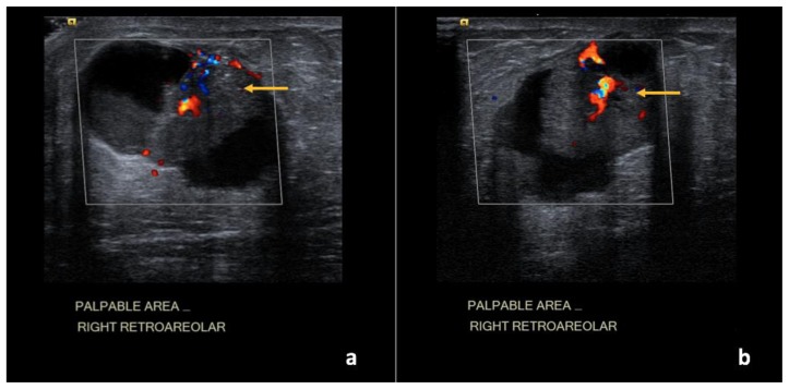 Figure 23