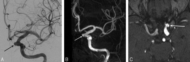 Fig 2.