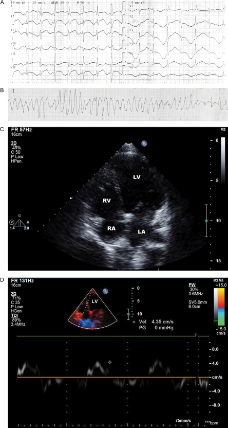 Figure 2