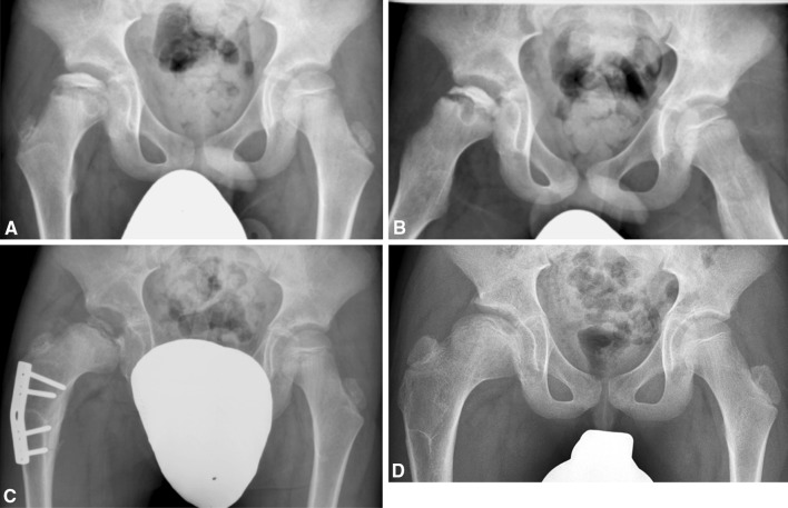 Fig. 1A–D