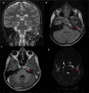 Fig 2: