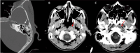 Fig 4: