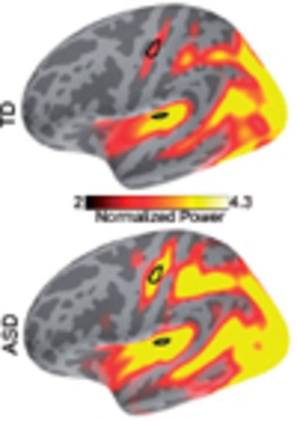 graphic file with name awv043fig1g.jpg