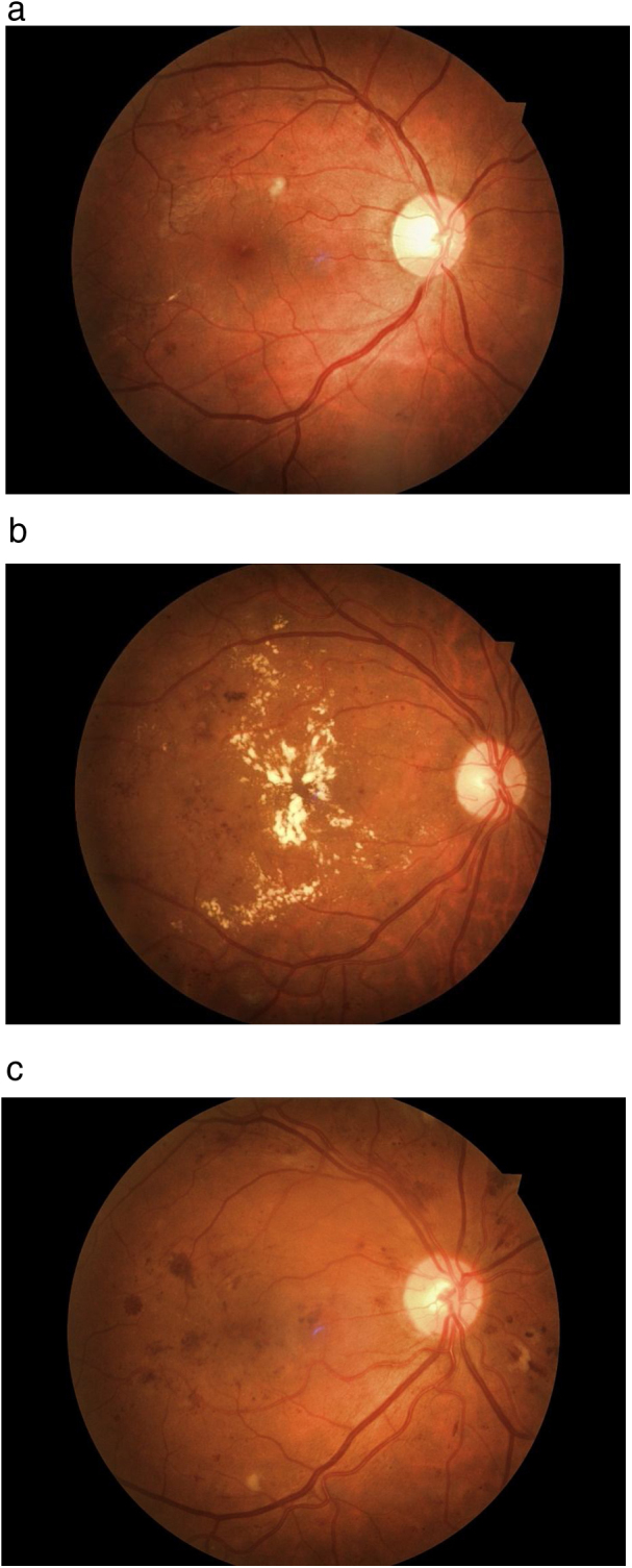 Fig. 2