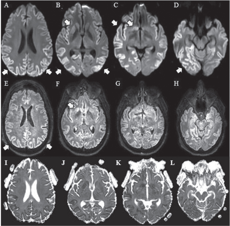 Fig.1