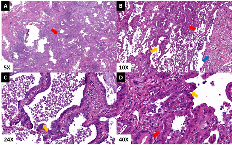 Fig. 2