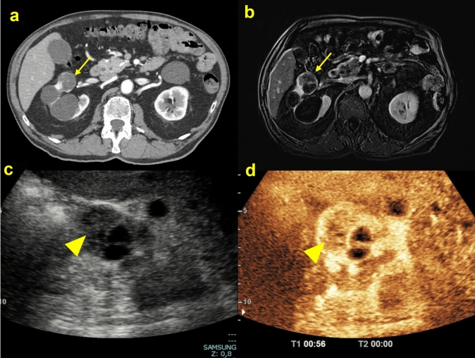 Fig. 9