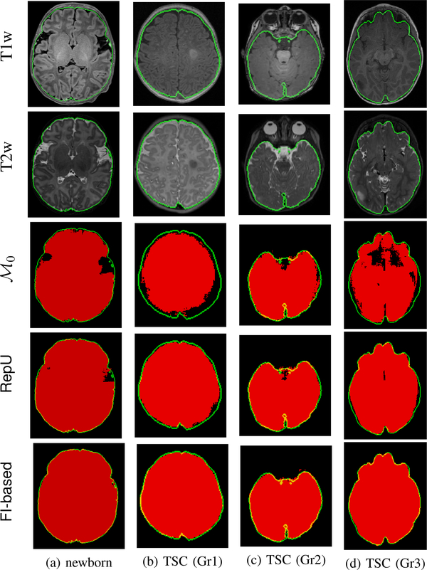 Fig. 11.