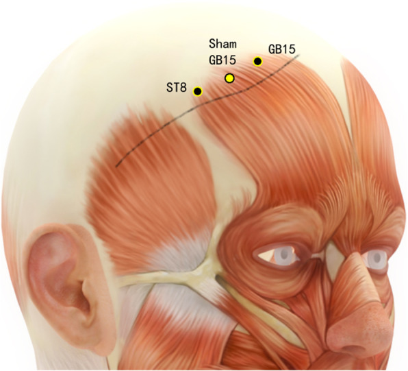 Fig. 4