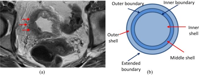 Figure 1