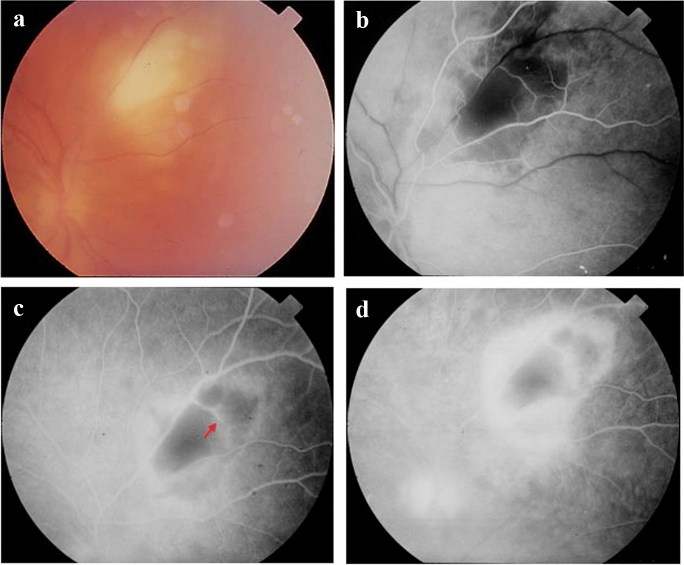 Fig. 6