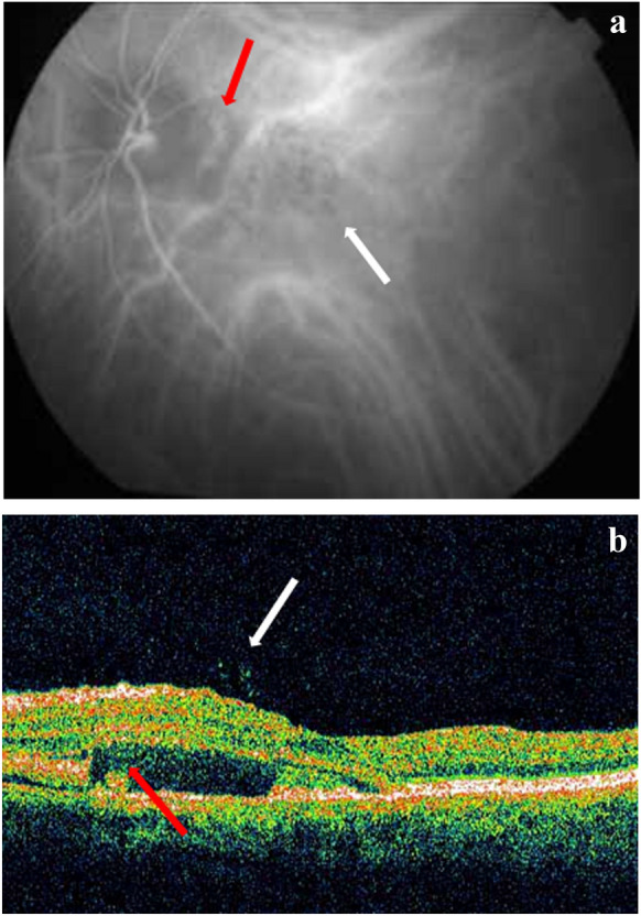 Fig. 5