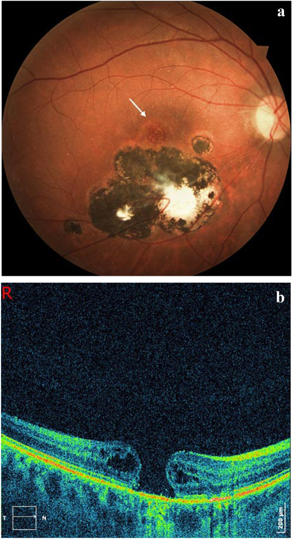 Fig. 4