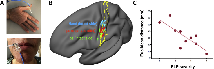 Fig. 2