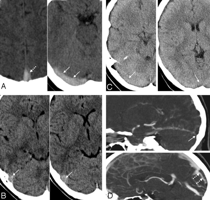 Fig 2.