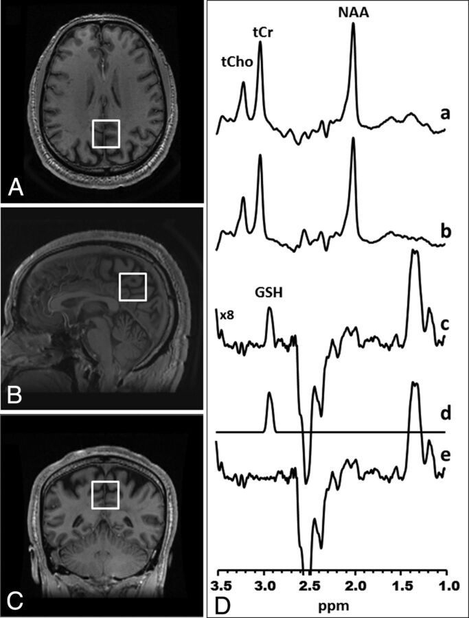 Fig 1.