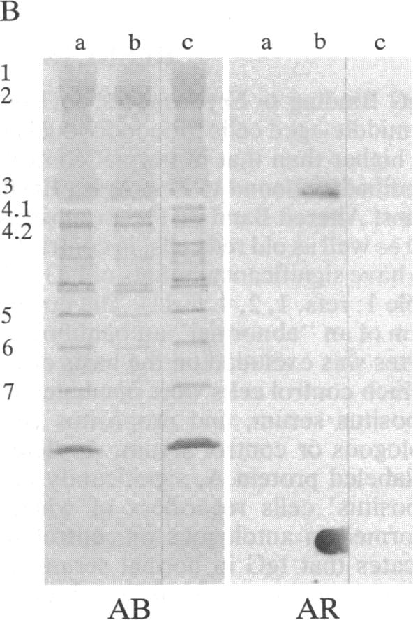 graphic file with name pnas00282-0174-a.jpg