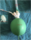 Fig. 1