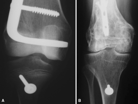 Fig. 3A–B