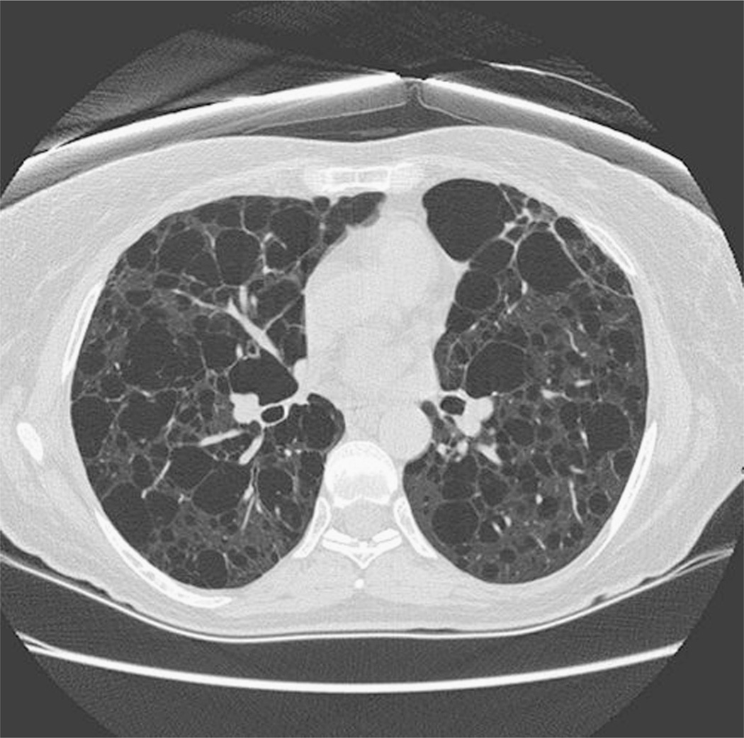 FIGURE 12