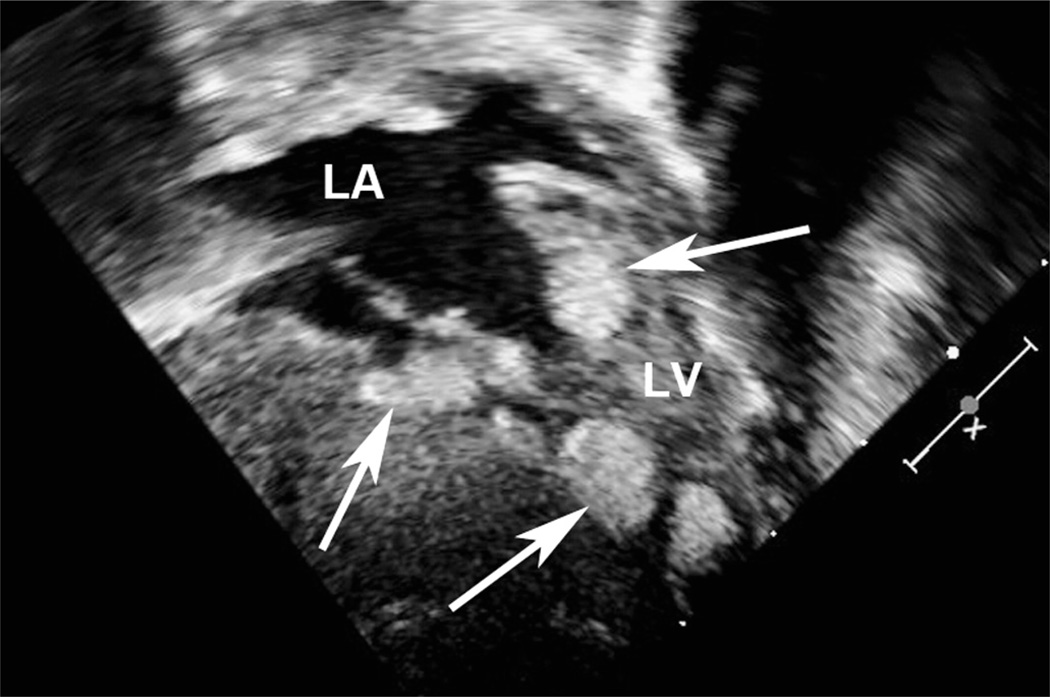 FIGURE 11