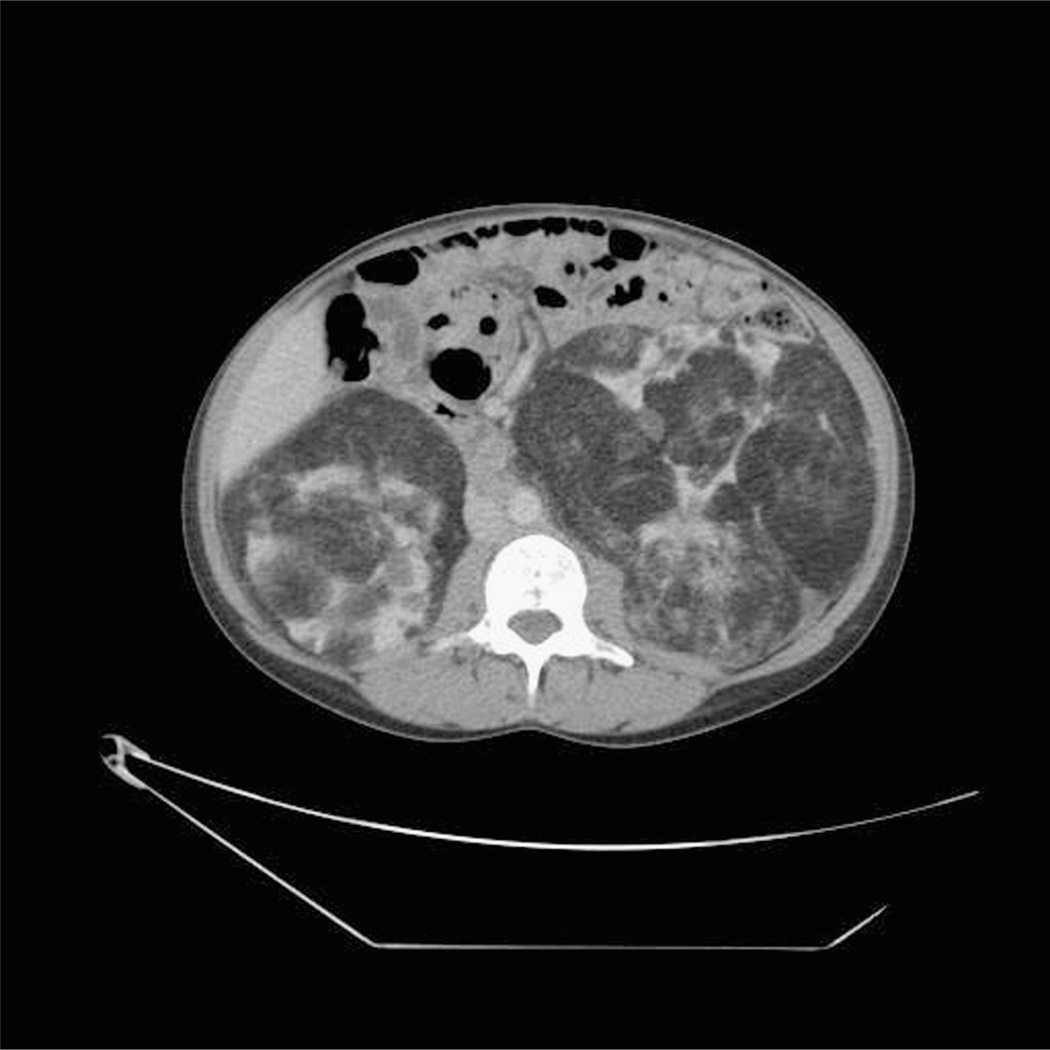 FIGURE 13