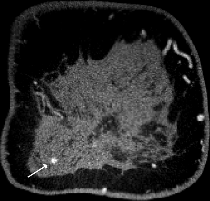 Figure 2c: