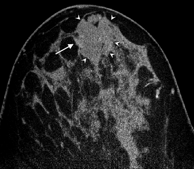 Figure 4a: