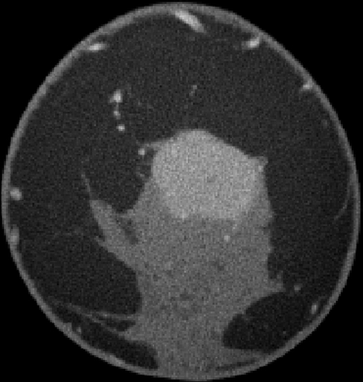 Figure 1c: