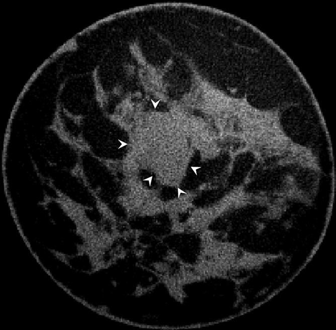 Figure 4b: