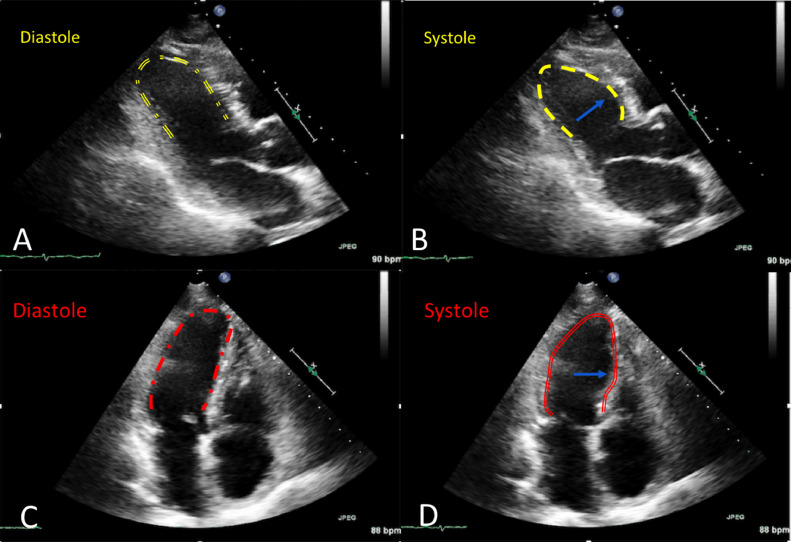 Fig 2