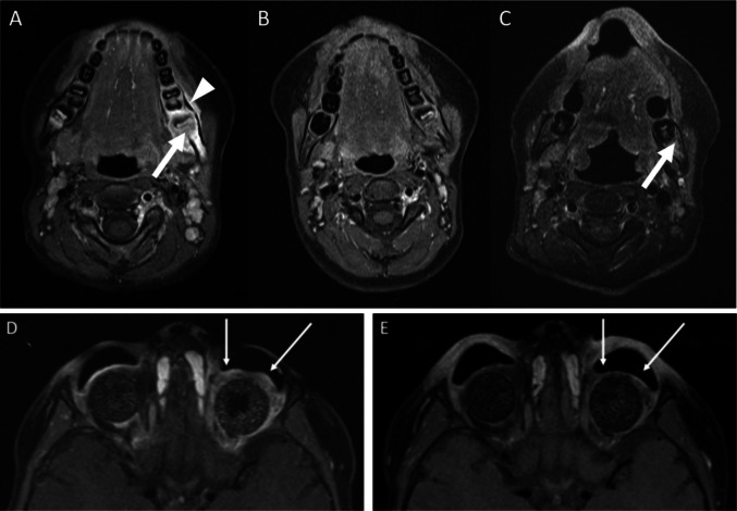Fig. 3