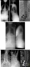 Fig. 11