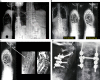 Fig. 12