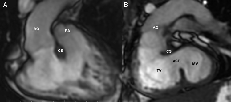 Figure 1: