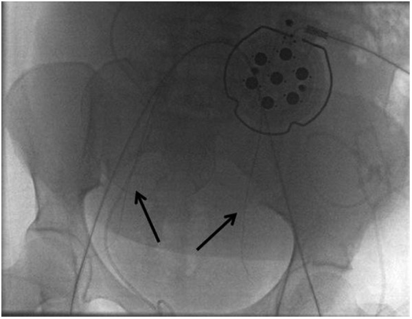 Figure 5