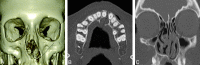 Fig 4.