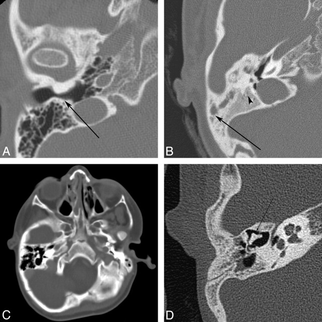 Fig 5.