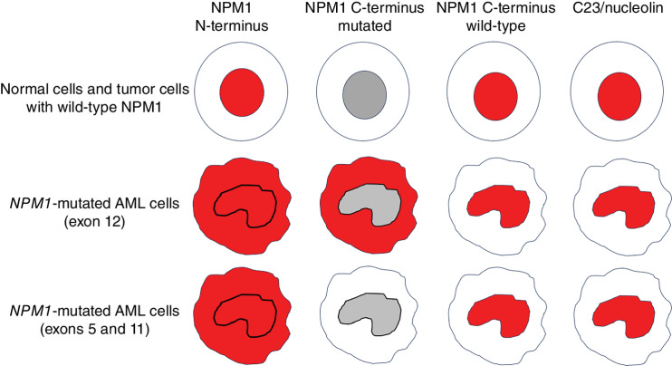 Figure 1. Representative examples of subcellular (nuclear and/or cytoplasmic) expression of NPM1 and nucleolin (red staining) in normal tissues, NPM1 wild-type tumors, and NPM1-mutated AML.