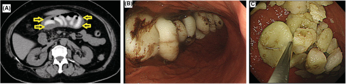 FIGURE 1