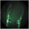 Fig. 19